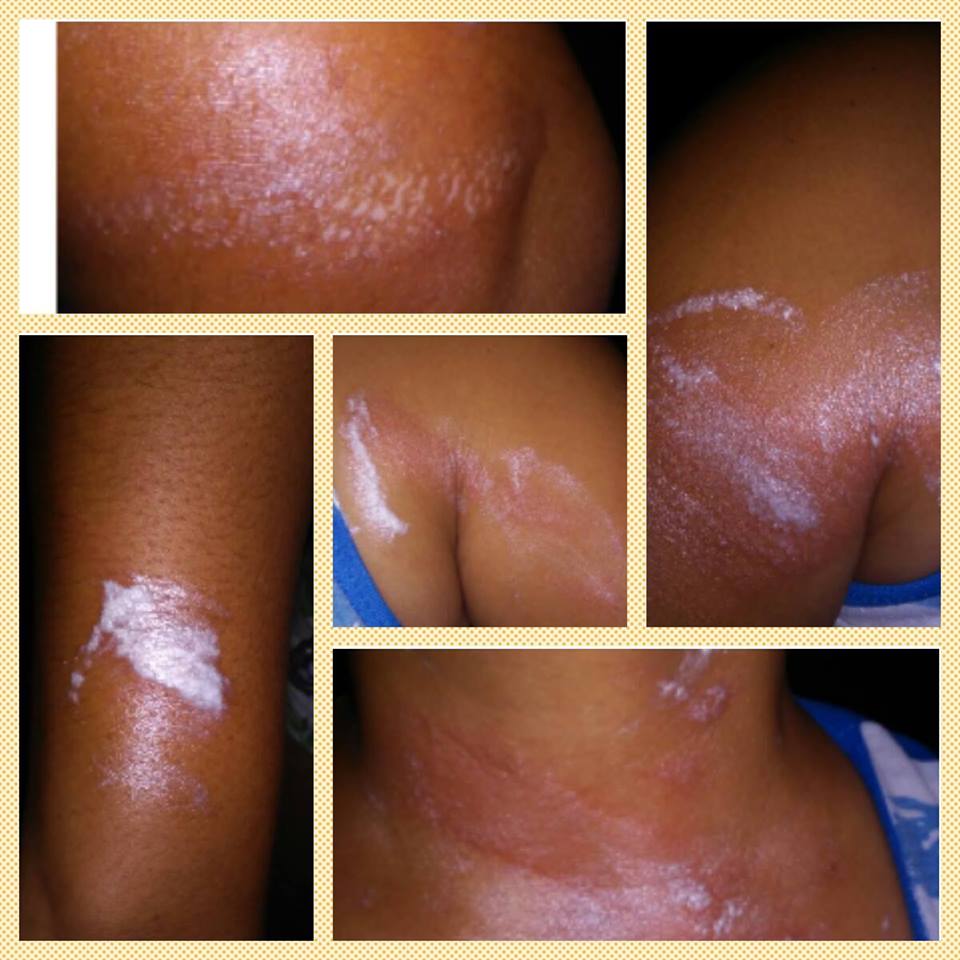 11072447_10152689971766408_6105020585741885915_n