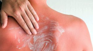 Uso de Protector Solar