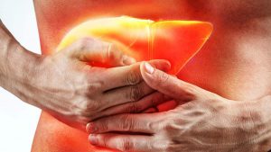 Cirrosis