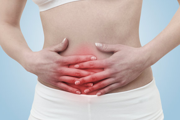 Colitis